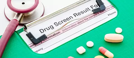 CDL Drug Test for Truck Drivers